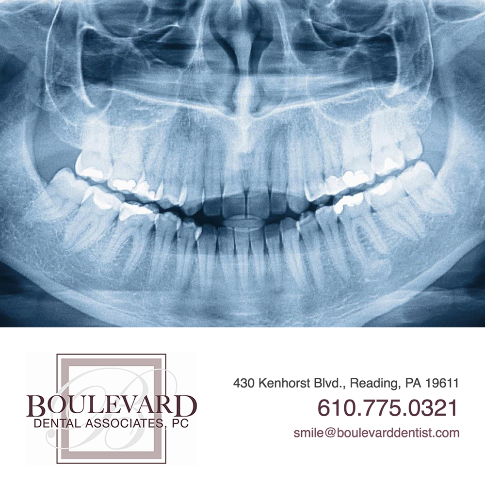 X-Rays Don’t Just Help Find Cavities!